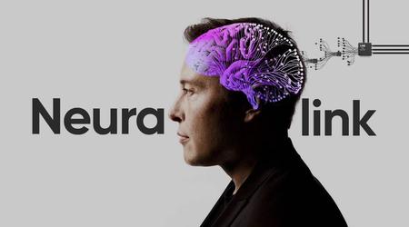 El Departamento de Agricultura de EE.UU. abre una investigación contra Neuralink, de Elon Musk, por sus experimentos con animales.