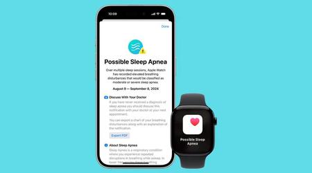 El Apple Watch ya detecta la apnea del sueño en Brasil: nueva función disponible para los usuarios