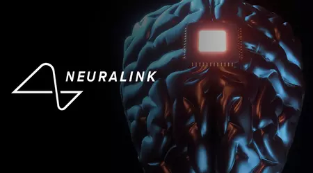 Ampliación del programa Neuralink: voluntarios de todo el mundo pueden solicitar ahora la implantación del innovador neurochip.