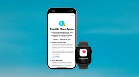 El Apple Watch recibe la aprobación canadiense para detectar la apnea del sueño