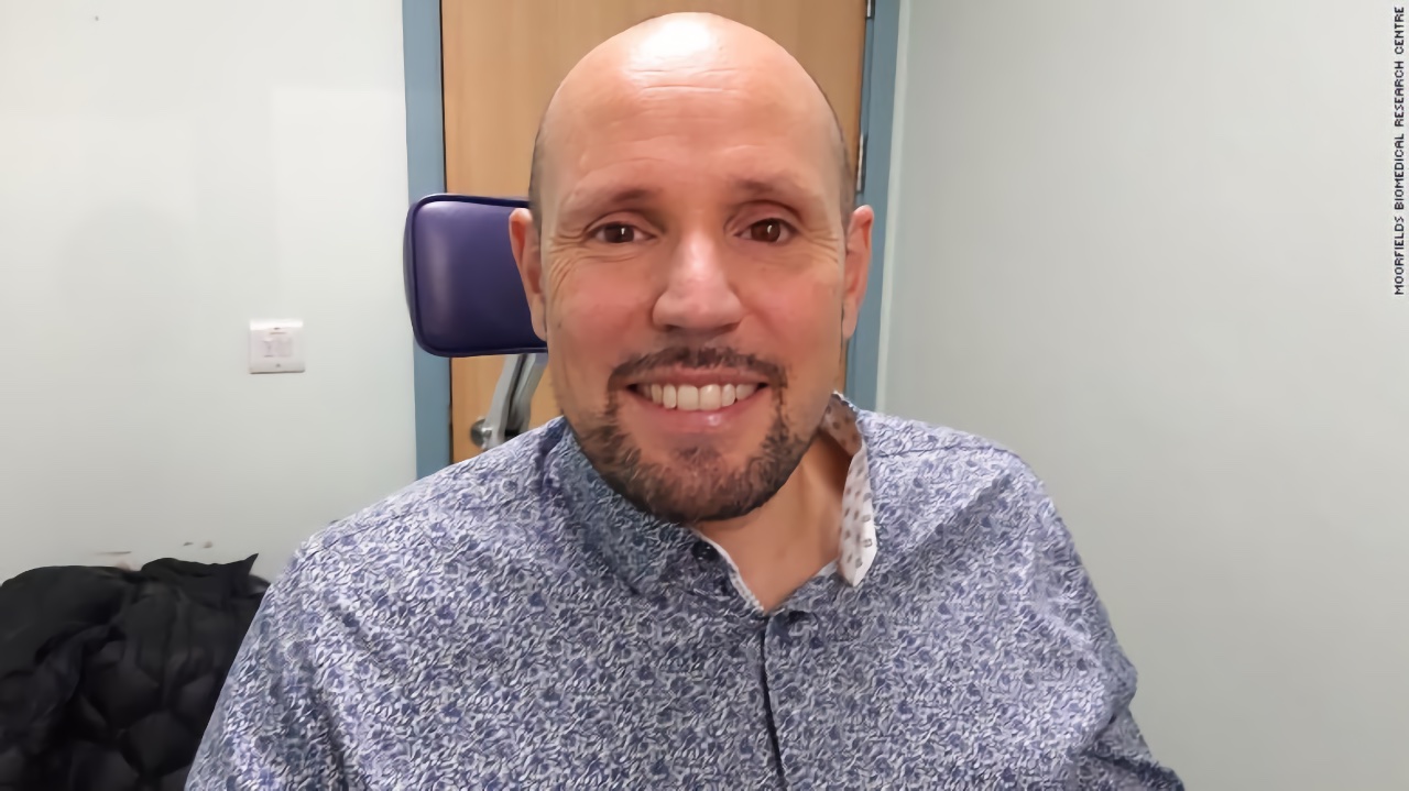Prótesis ocular impresa en 3D implantada por primera vez en seres humanos Prótesis ocular impresa en 3D implantada por primera vez en seres humanos