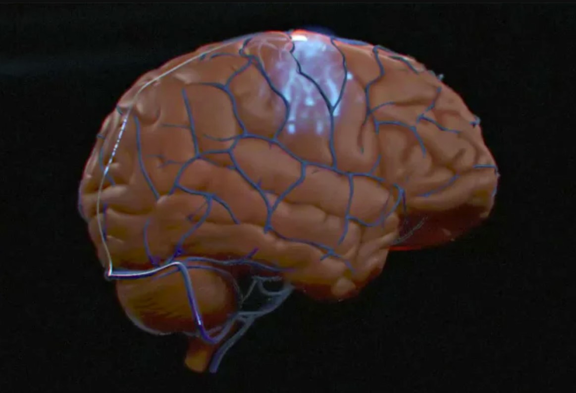 Synchron es la primera en implantar una interfaz cerebro-ordenador en Estados Unidos Synchron es la primera en implantar una interfaz cerebro-ordenador en Estados Unidos