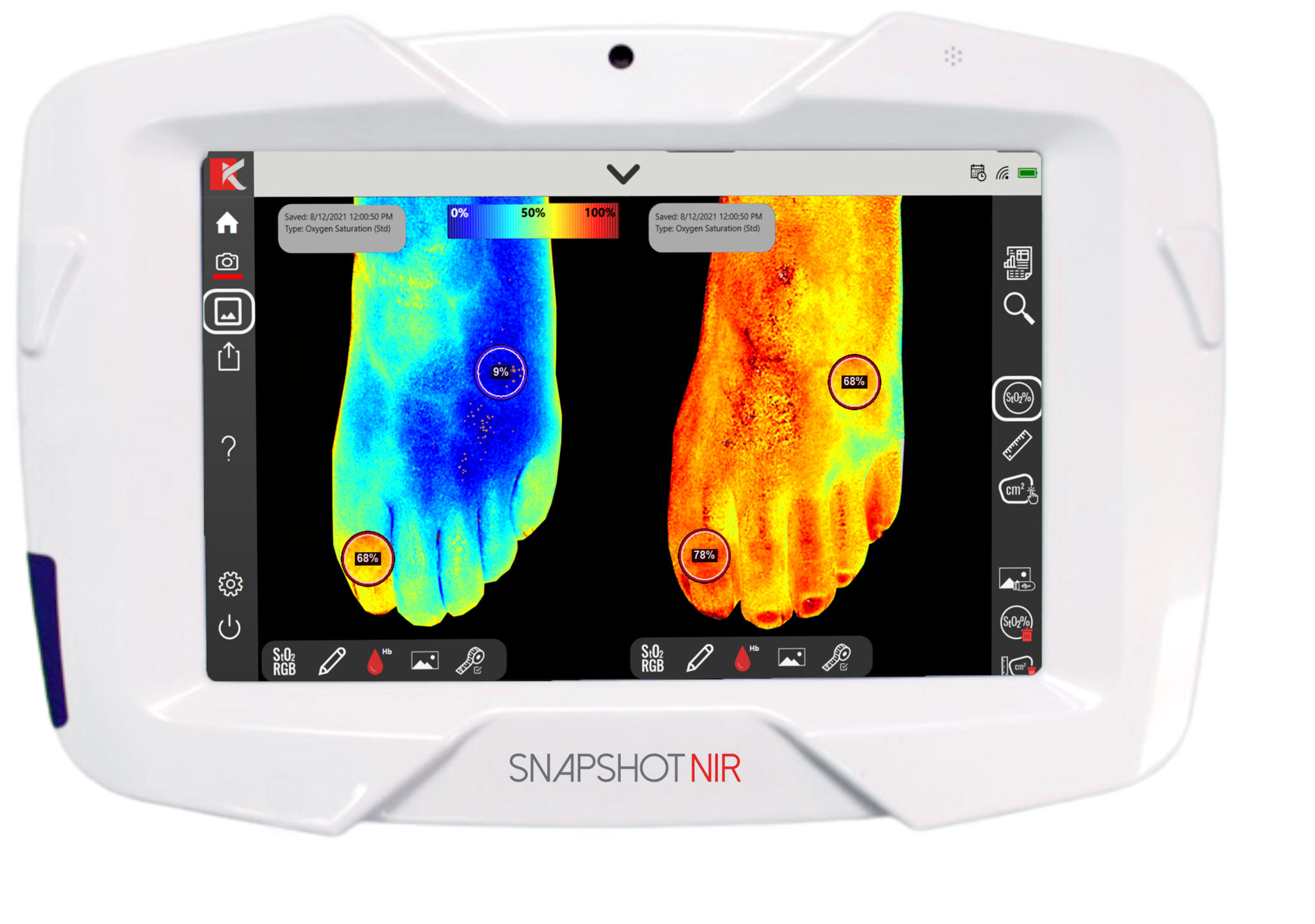 Dispositivo de diagnóstico portátil "Snapshot NIR" para sustituir a los ultrasonidos y los rayos X Dispositivo de diagnóstico portátil "Snapshot NIR" para sustituir a los ultrasonidos y los rayos X