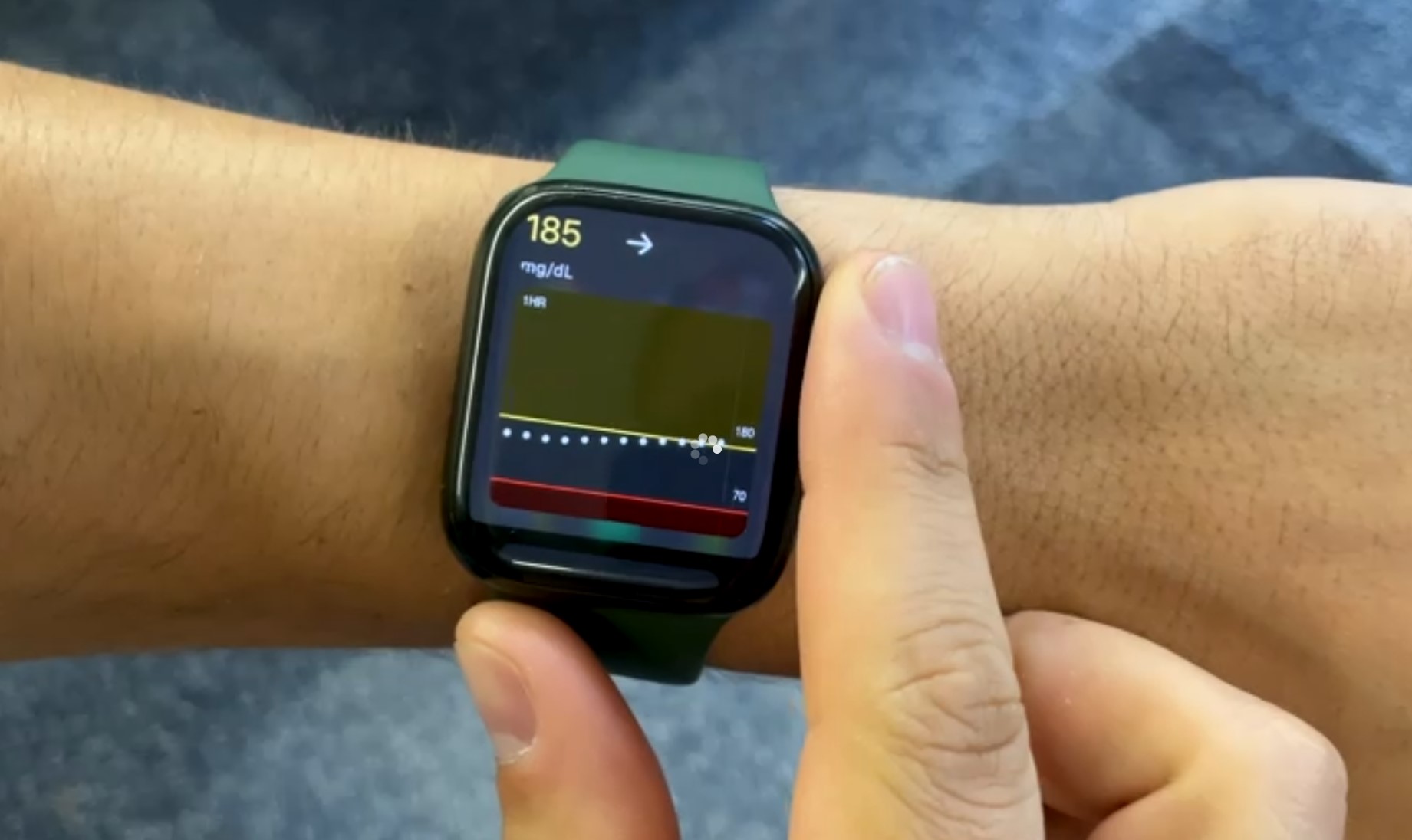 El videógrafo de CNET y diabético Justin Eastzer dice que el Apple Watch le salvó la vida El videógrafo de CNET y diabético Justin Eastzer dice que el Apple Watch le salvó la vida