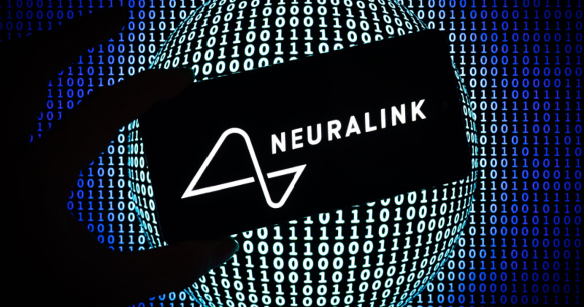 Se detectan irregularidades en las pruebas de Neuralink en EE.UU. Se detectan irregularidades en las pruebas de Neuralink en EE.UU.