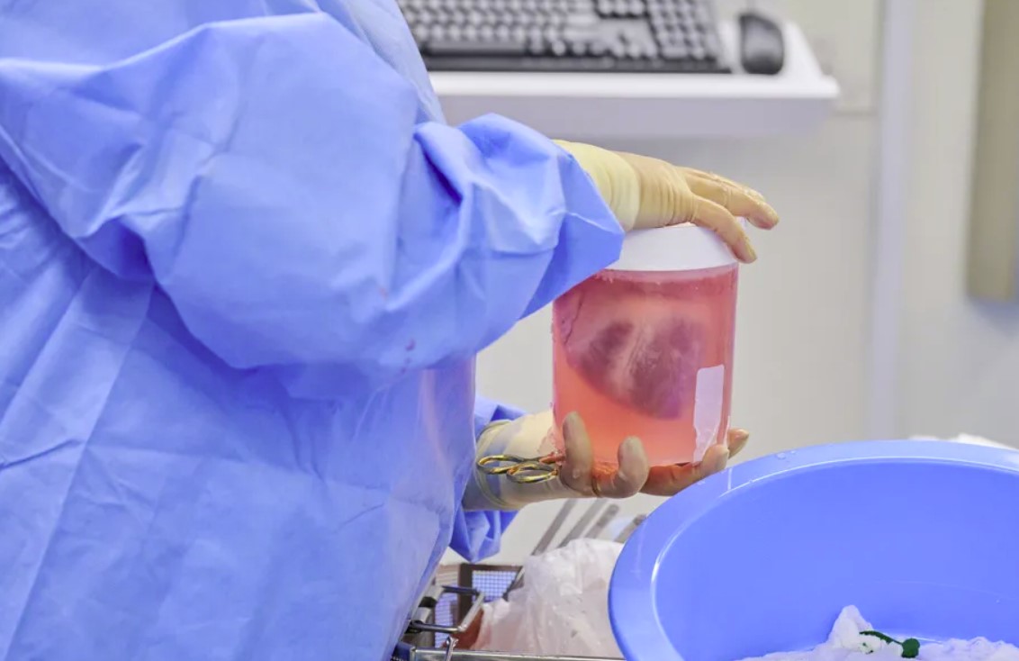 Los investigadores han trasplantado corazones de cerdo modificados genéticamente en los cuerpos de personas muertas Los investigadores han trasplantado corazones de cerdo modificados genéticamente en los cuerpos de personas muertas