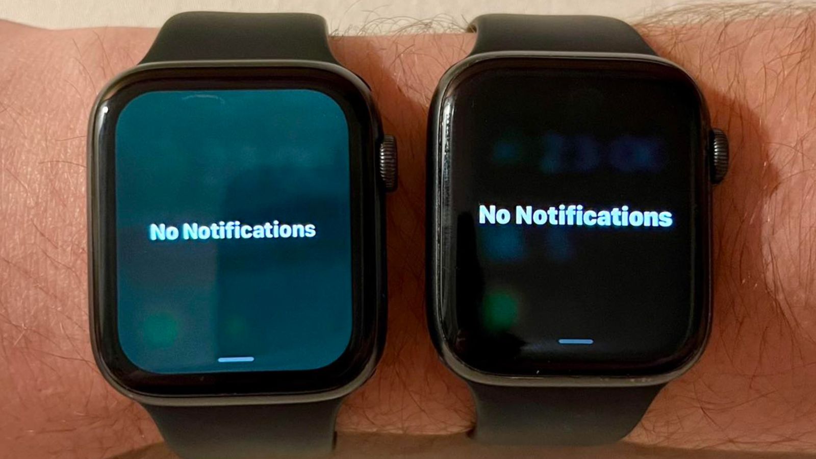 Algunos Apple Watch se han vuelto 'verdes' tras actualizar a watchOS 9.5 Algunos Apple Watch se han vuelto 'verdes' tras actualizar a watchOS 9.5