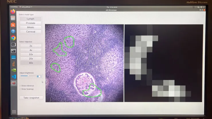 Google y el Pentágono han desarrollado un microscopio basado en inteligencia artificial para el diagnóstico del cáncer-3 Google y el Pentágono han desarrollado un microscopio basado en inteligencia artificial para el diagnóstico del cáncer-3